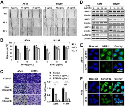 Bioactivity-guided fractionation of Helicteres angustifolia L. extract and its molecular evidence for tumor suppression